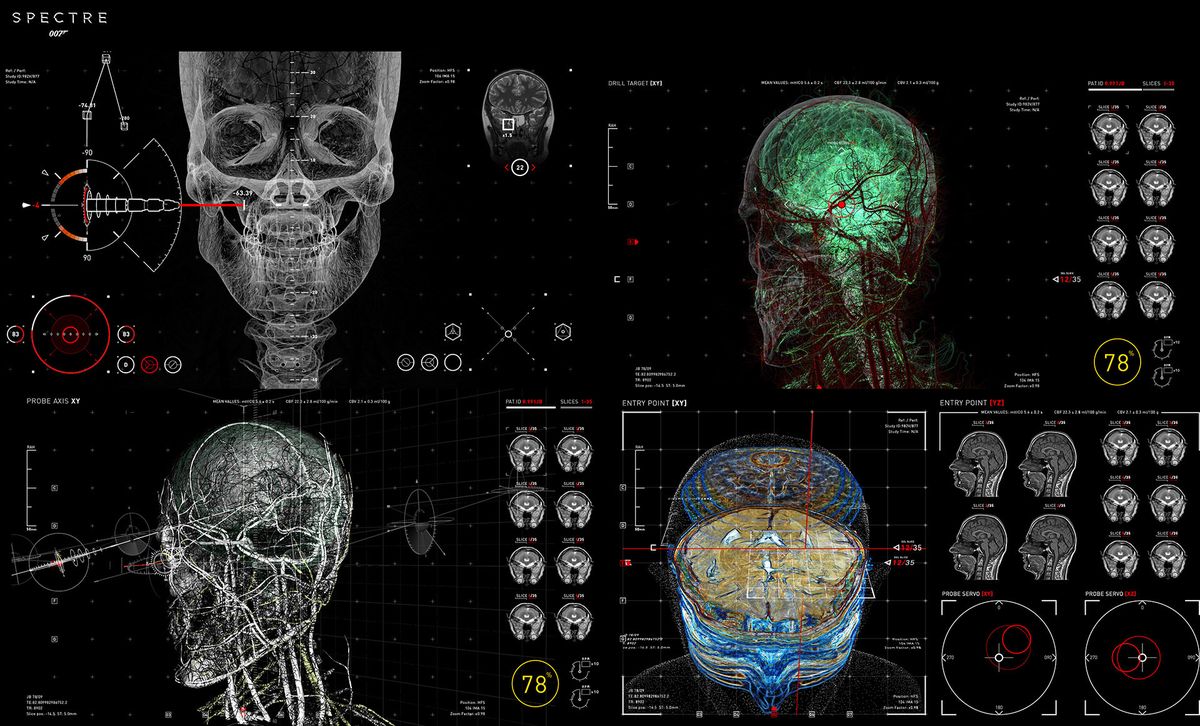 Multi-modal cortical scan with probe targeting overlays